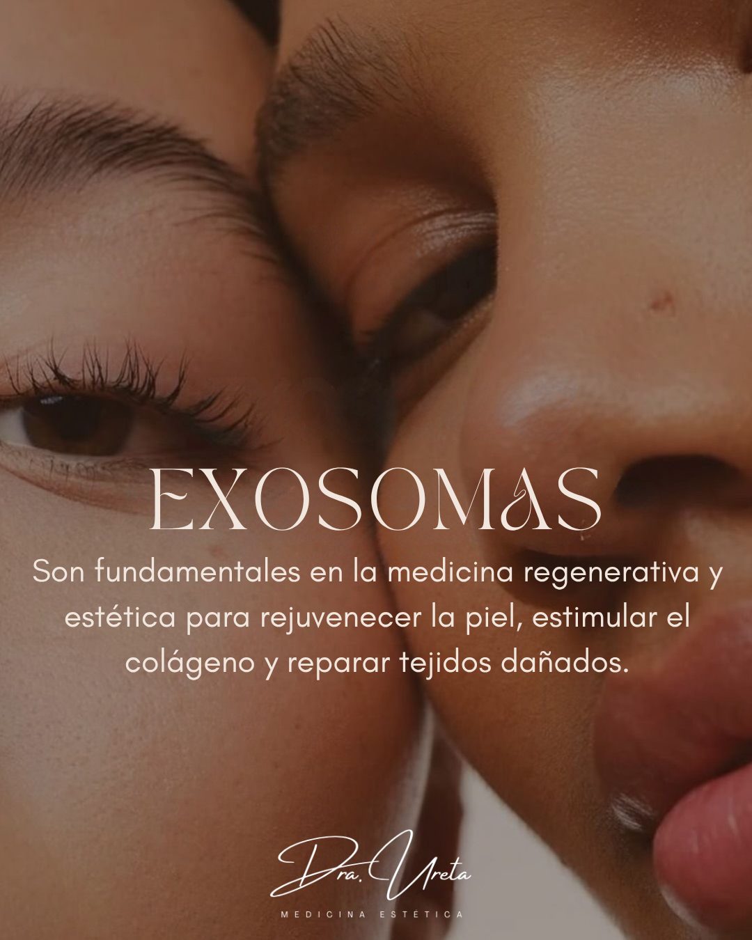 Exosomas